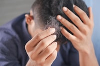 5 Ways To Reverse Hair Loss