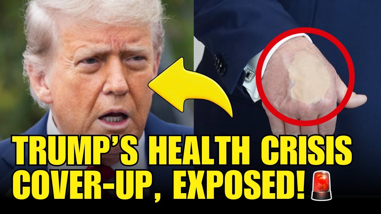 Shocking News About Trump’s Health He Doesn’t Want You To See!🚨