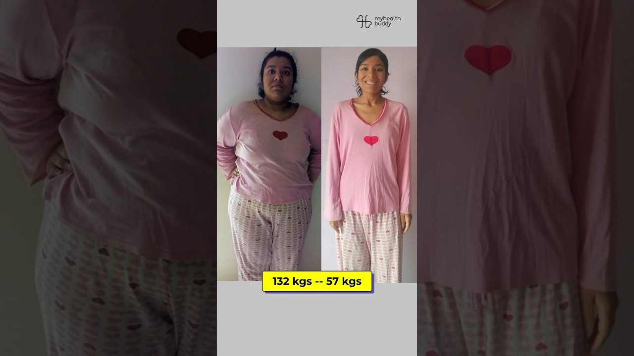 75 kgs Full Body Weight Loss (😳 132 kgs – Starting Weight)