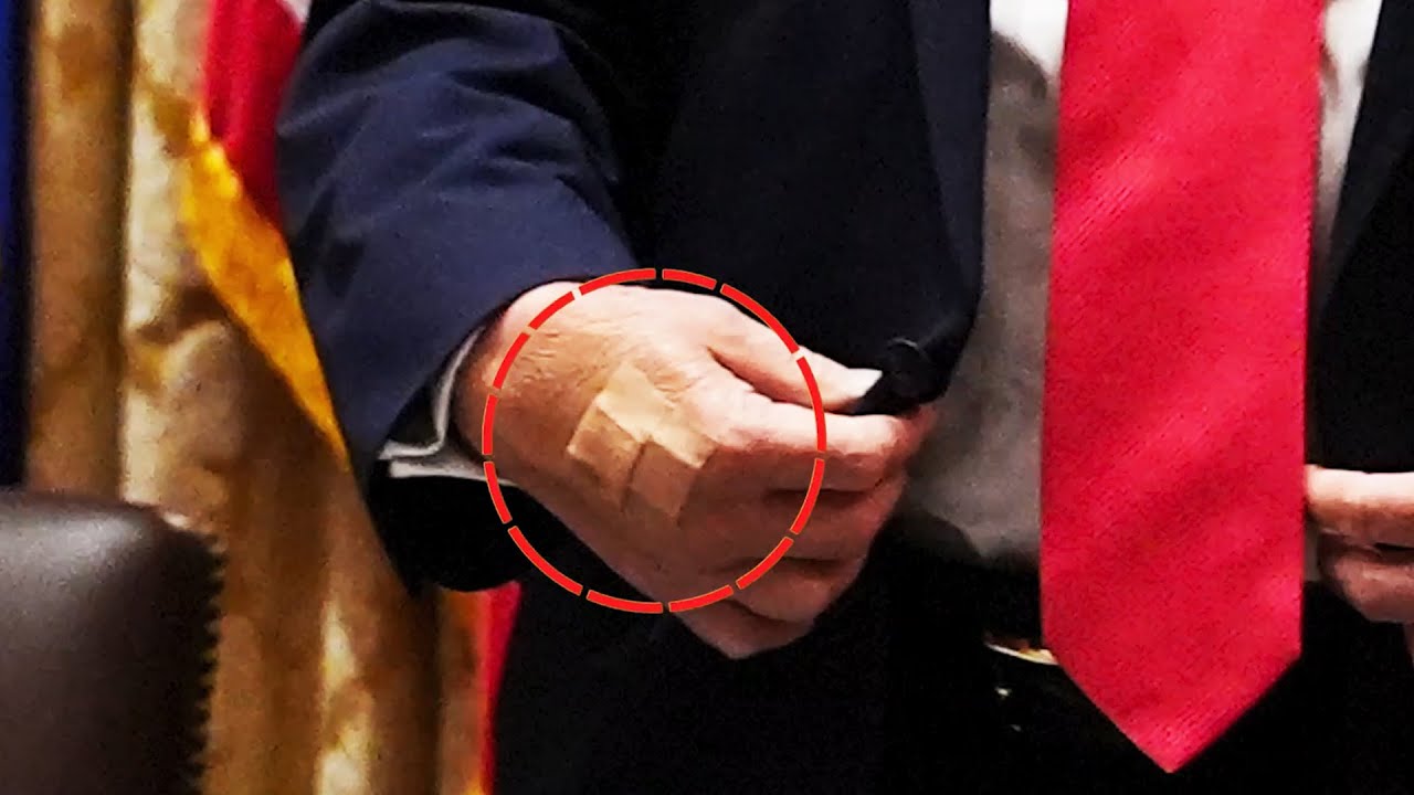 TRUMP HEALTH PANIC: NOW IT’S BANDAGES