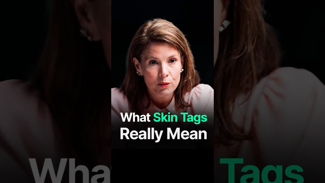 SHOULD YOU BE WORRIED ABOUT SKIN TAGS?